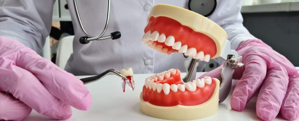 south gate wisdom teeth extractions