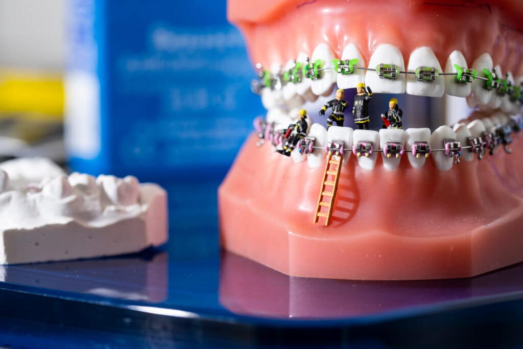 braces southgate